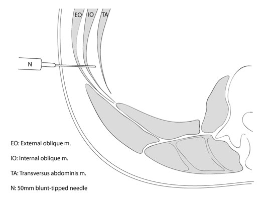 Concept of the TAP block