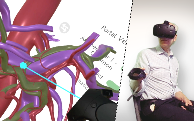 Surgical HPB anatomy presented in VR