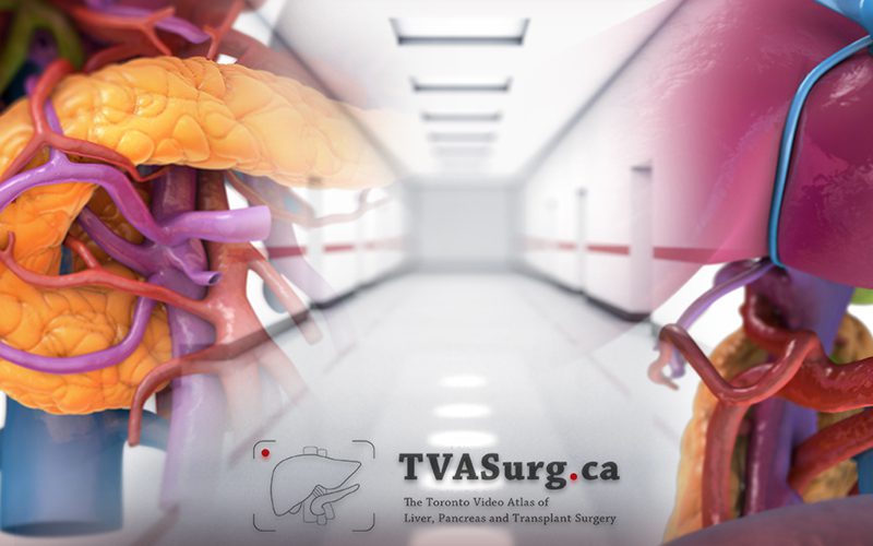 Surgical dissection using anatomical “gateways”