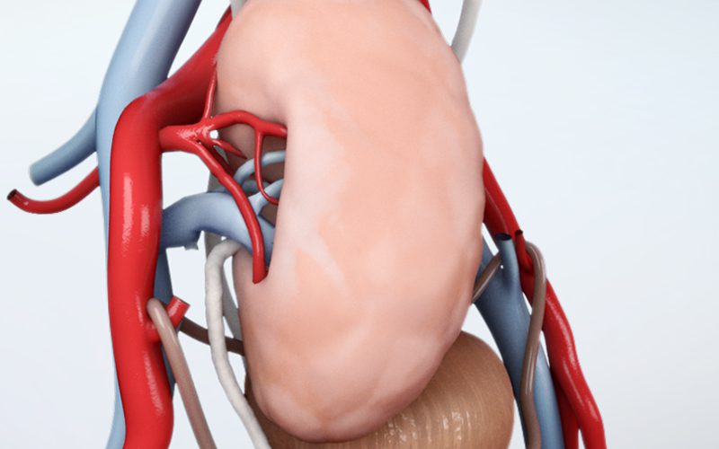 Living donor kidney transplant Part II: Implantation of the kidney graft