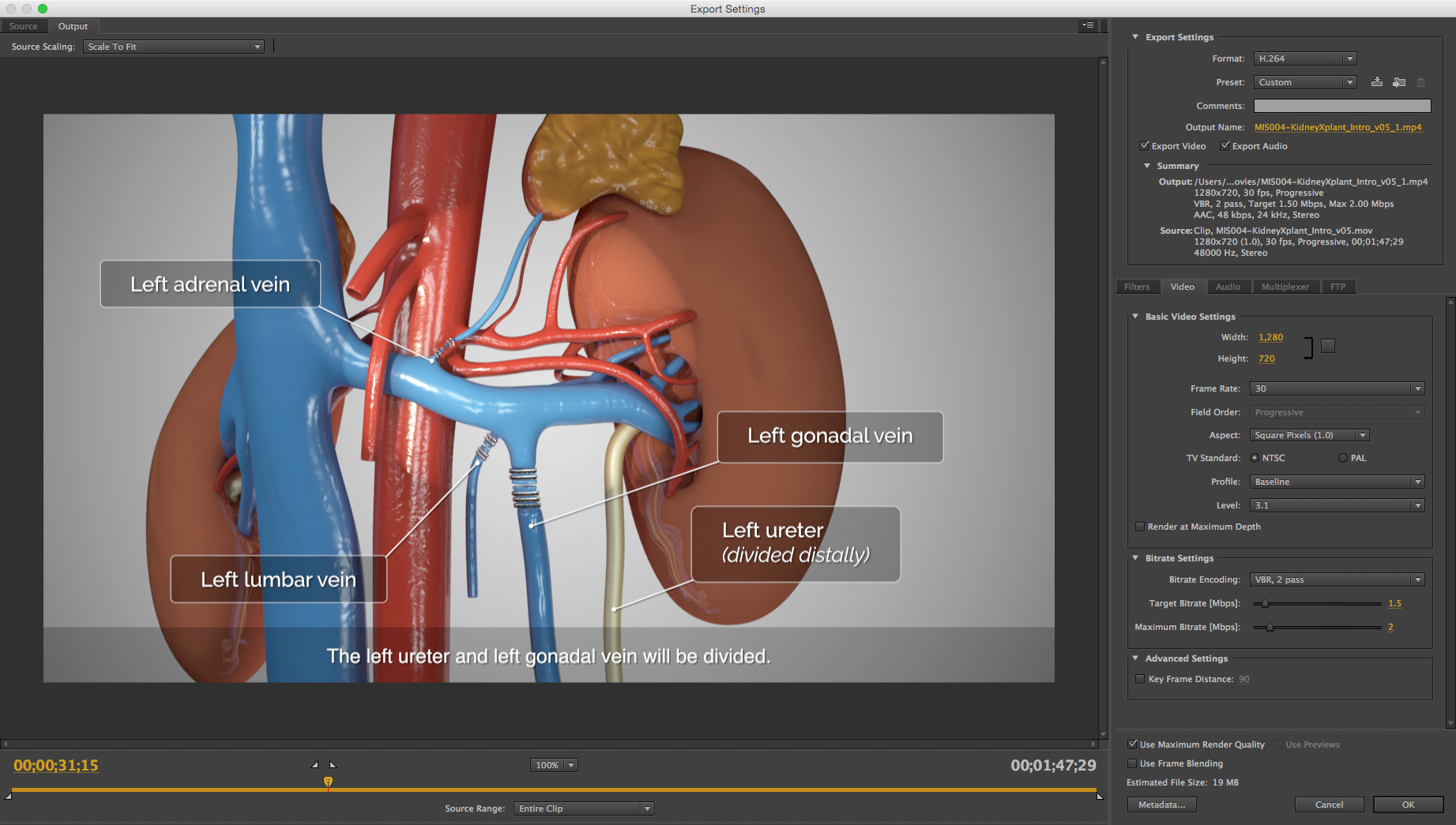 Video compression settings