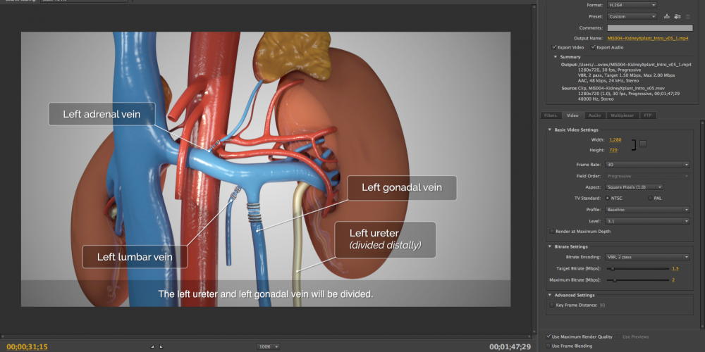 Video Editing Tips for Surgeons, Pt.1: Resolution