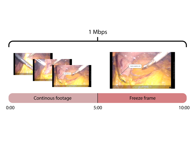 Video Editing Tips for Surgeons, Pt. 3: Video bitrates