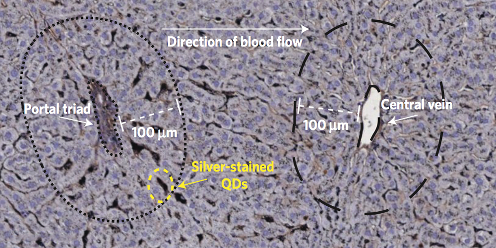 Nanoparticle research in the McGilvray & MacParland Labs – Pt1