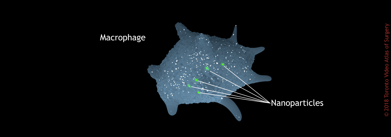 Macrophage with ingested nanoparticles