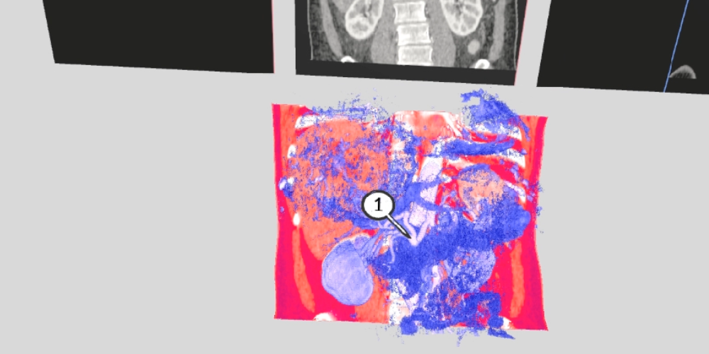 VR update: Operating room and Medical imaging VR modules