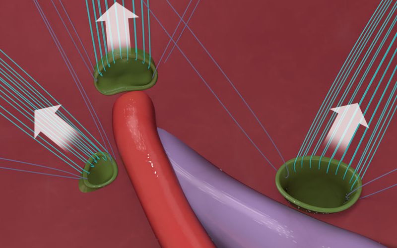 Complex Biliary Reconstruction