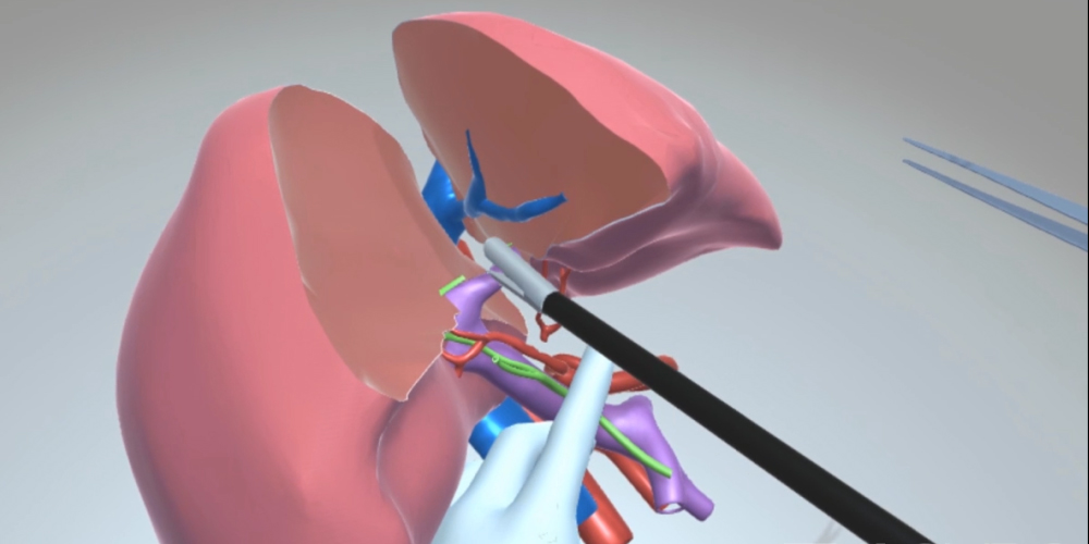 VR update: Surgical simulation module