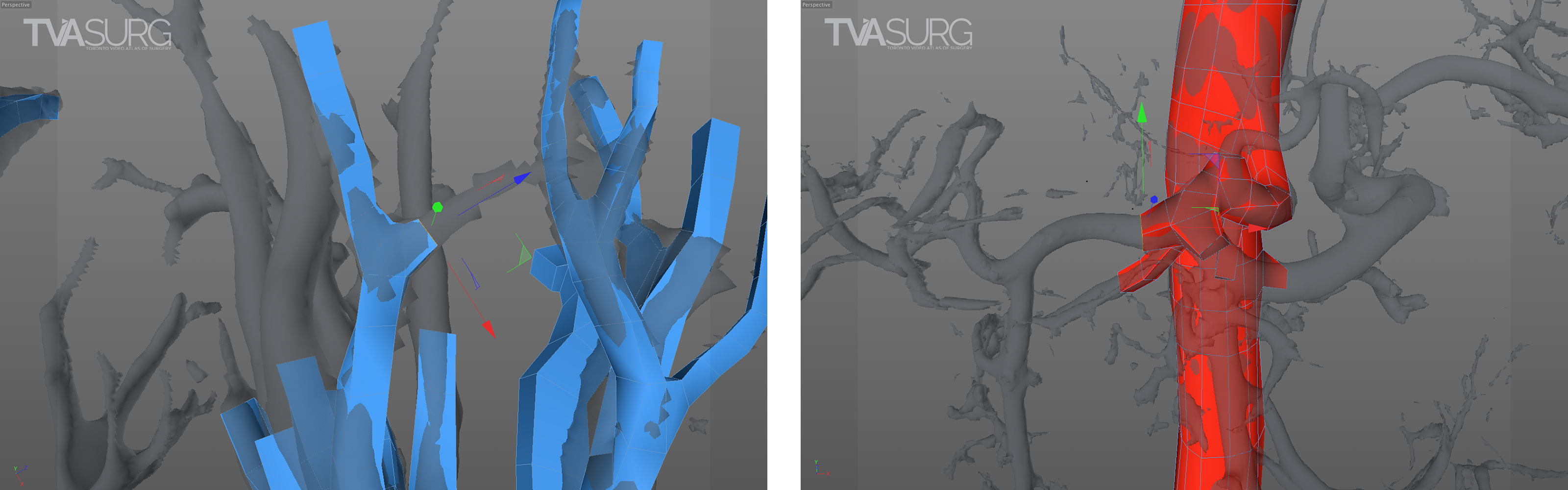 Vessel tracing