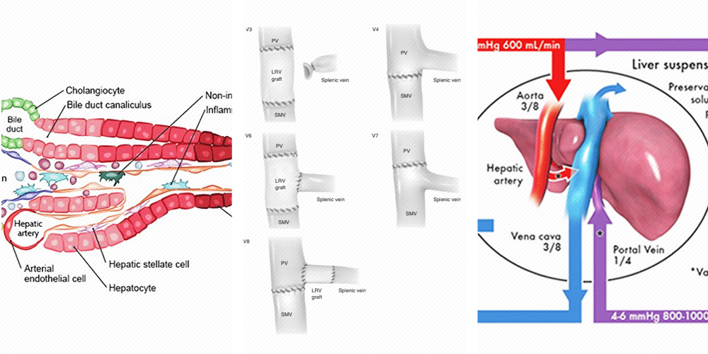 Collaborations with surgeons and scientists: Academic illustrations