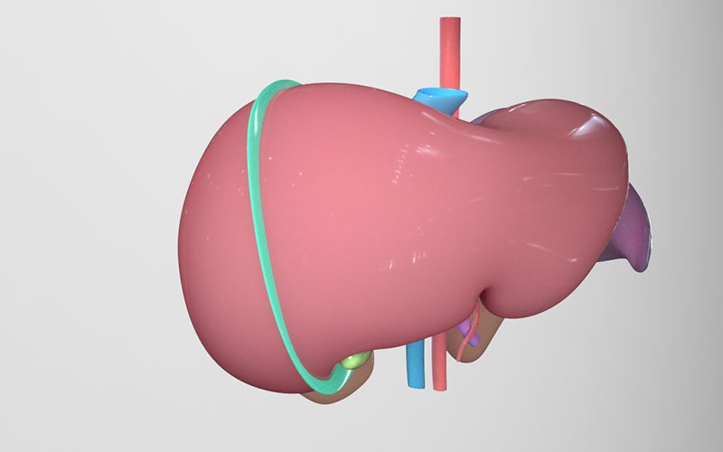 Laparoscopic pediatric right posterior sector resection