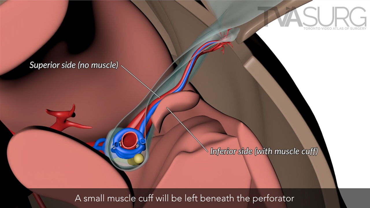 Cross section anatomy