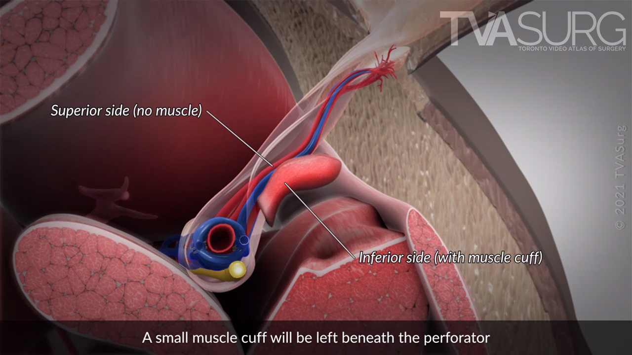 Final render of cross section anatomy