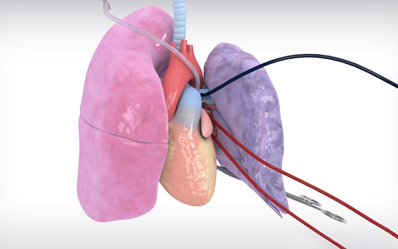 In Vivo Lung Perfusion