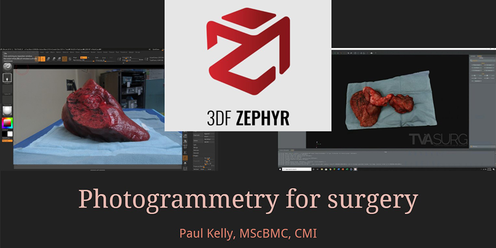 AMI Tech Talk: Photogrammetry for surgery