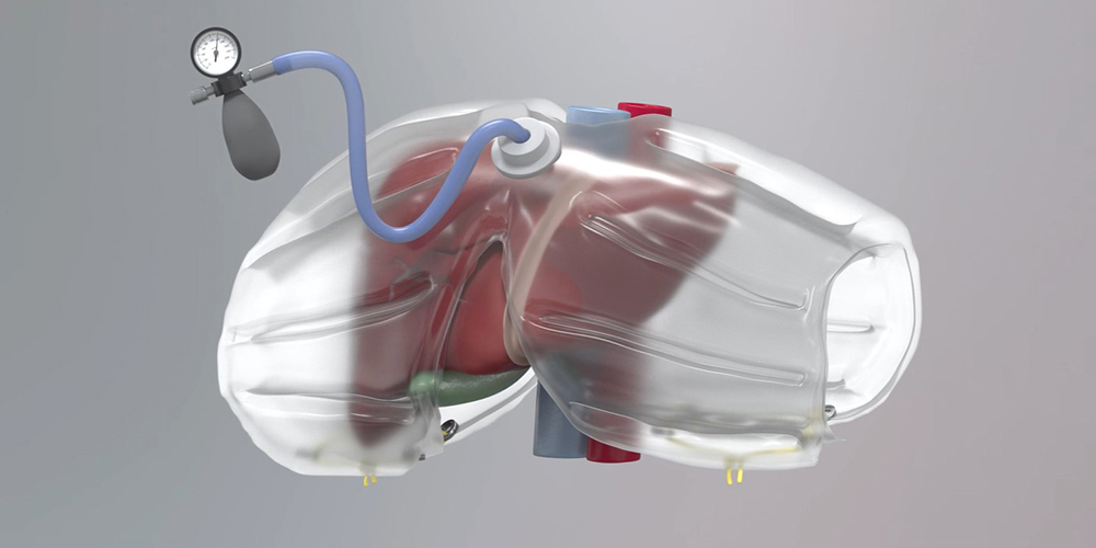 Dr. Rezende-Neto’s “Liver Airbag” 3D animation by Katrina Hass