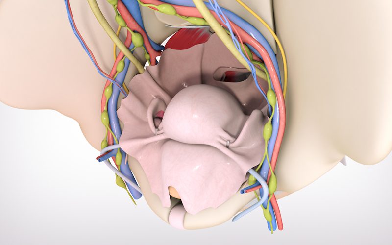 Total laparoscopic hysterectomy with ICG imaging