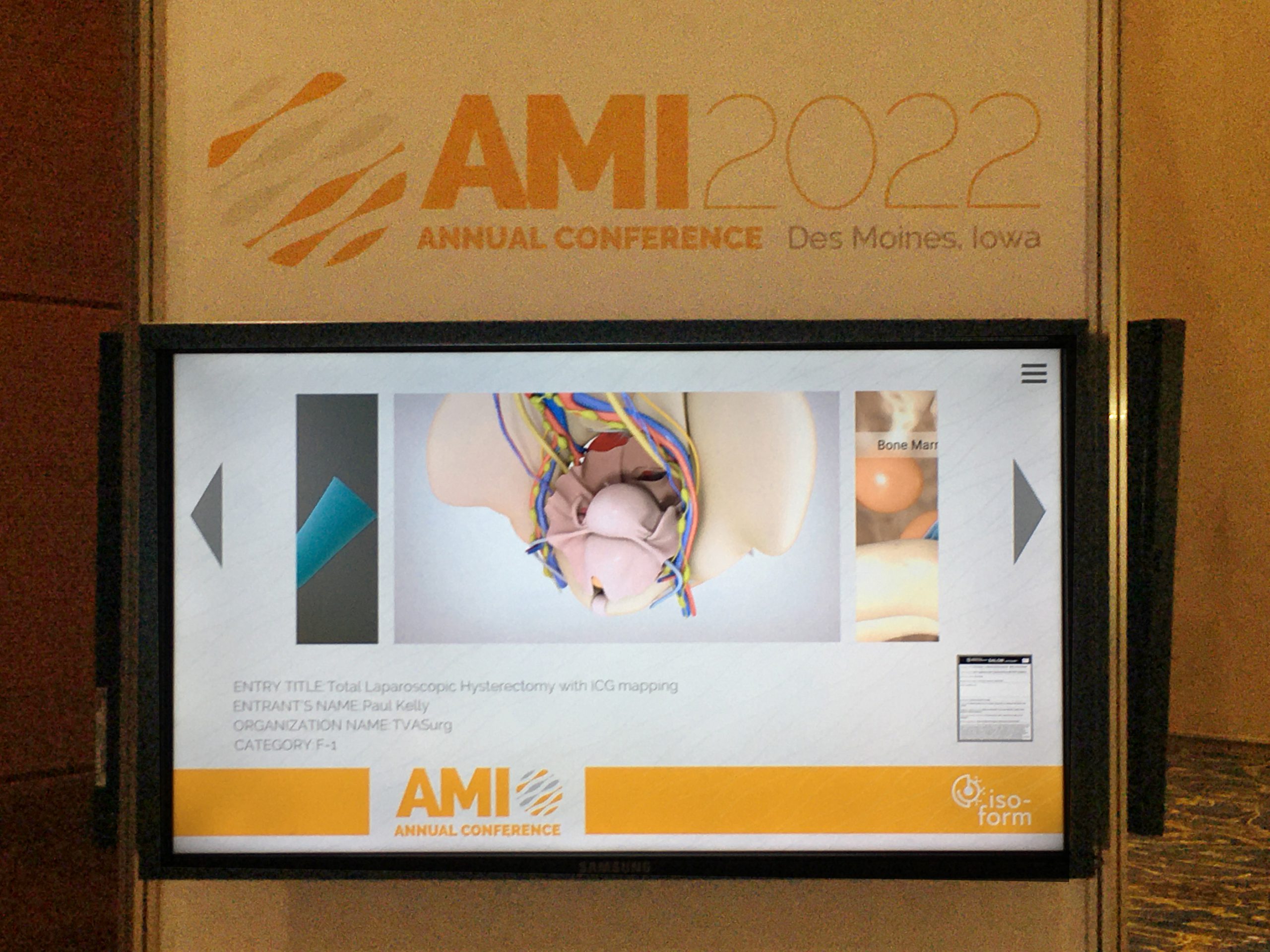 AMI 2022 Salon video - TLH w IcG