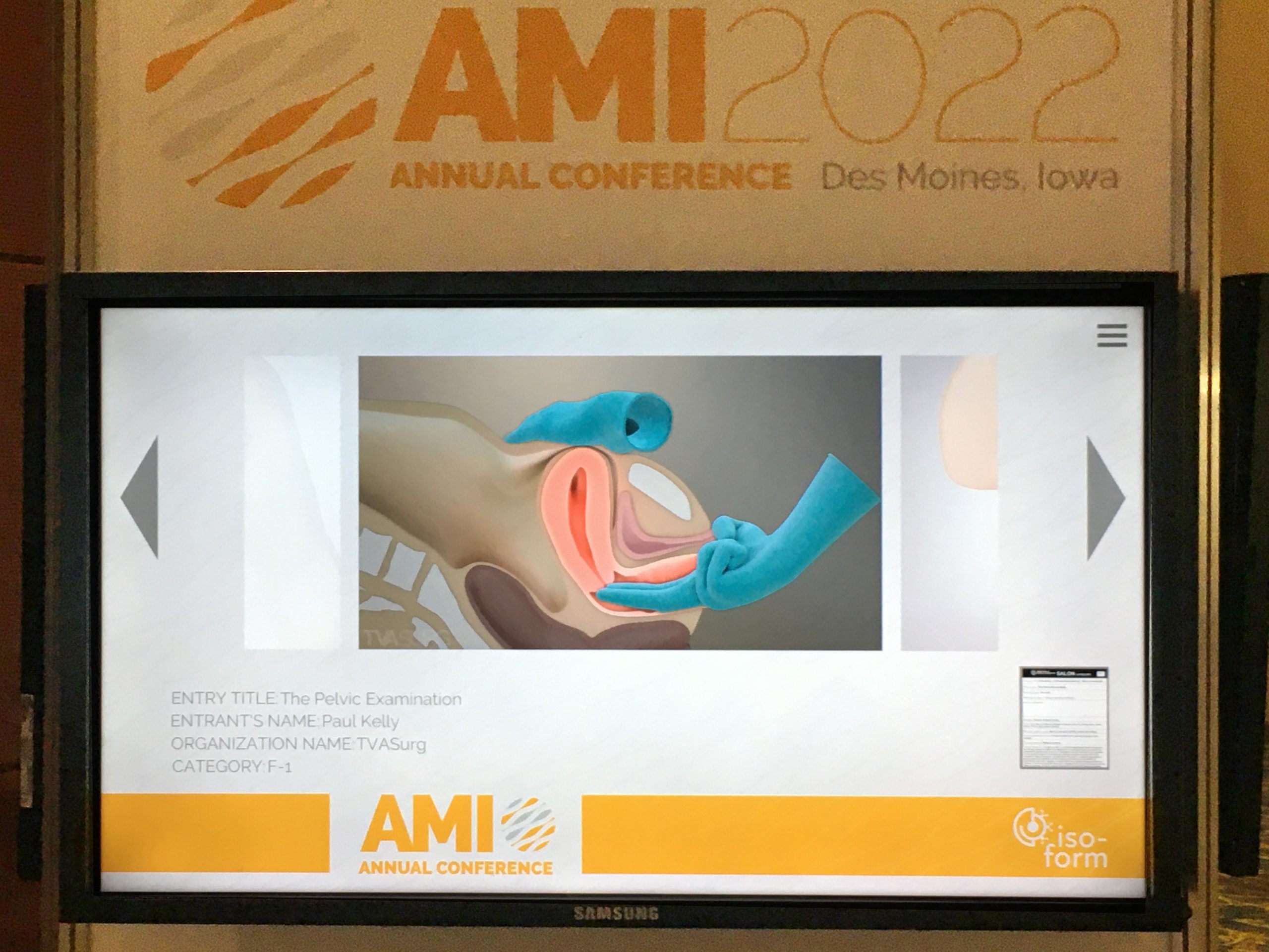 AMI 2022 Salon video - pelvic exam