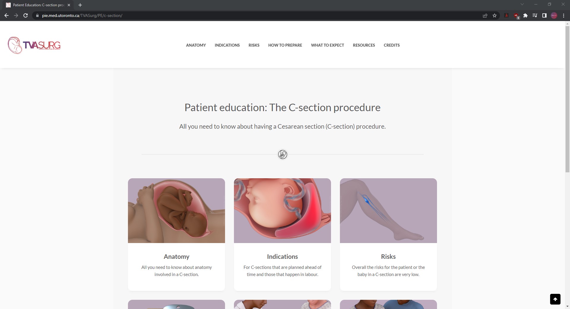 Cesarean section Patient Teaching site