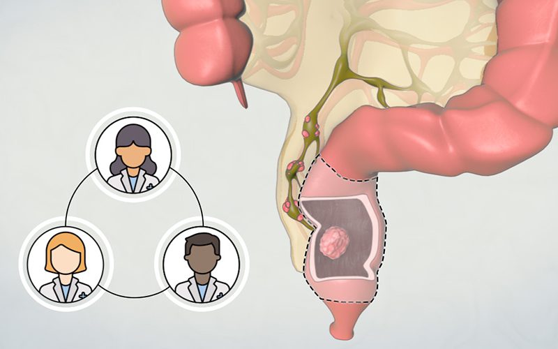 Patient Learning: Low Anterior Resection