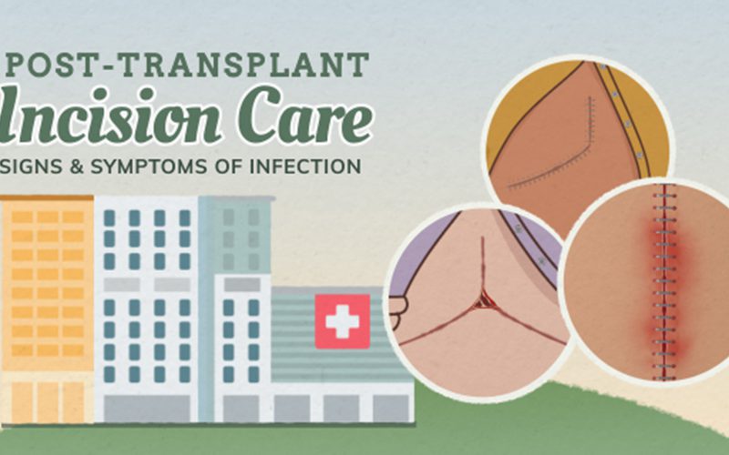 Patient Learning: Incision care after transplant surgeries