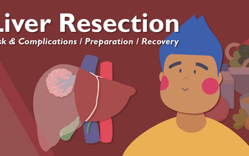 Patient Learning: Liver Resection