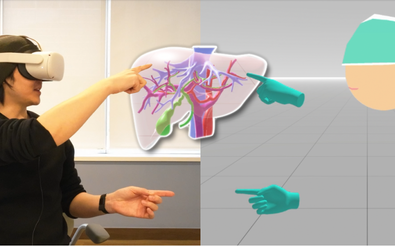 Basic liver anatomy for patients with Primary Sclerosing Cholangitis (PSC)